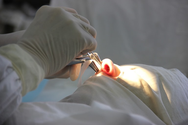 Лечение полипов в носу без операции: причины, симптомы, методы лечения заболевания