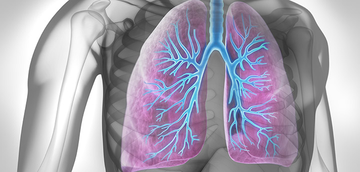 Неаллергическая астма