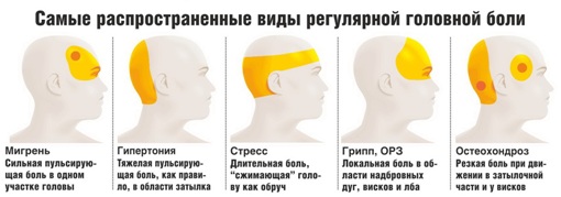 Классификация головной боли